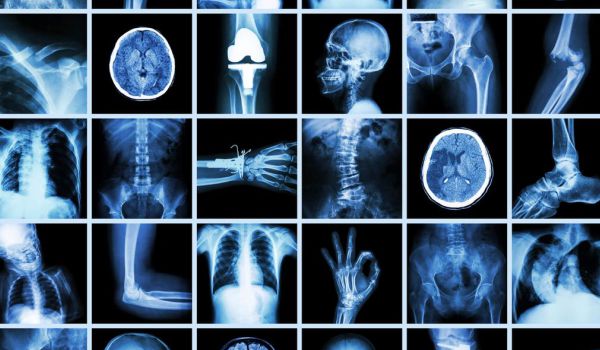 What is a Radiology And Radiology Salary